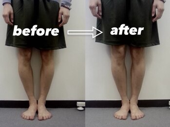 五反田整体 身体改善整体院/O脚X脚が一度でここまで改善整体