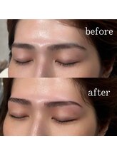 トゥモローズ(TOMOROWS)/ハリウッドブロウリフト