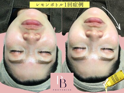 フォトビズの写真