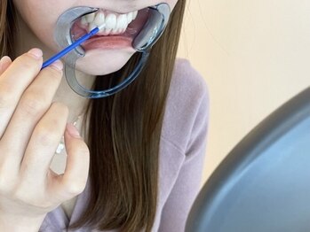 エクシアホワイトニング 天王寺店の写真/格安?!1ヵ月約1万円で通い放題プランをご用意◎【定額通い放題プラン♪】セルフホワイトニング1ヵ月¥11000