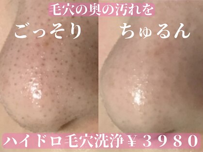 アイリープ(eyeleap)の写真