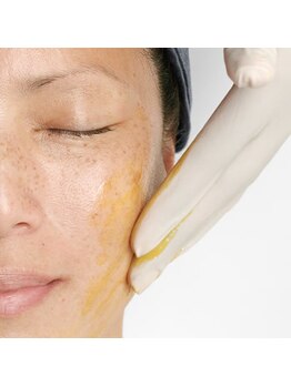 リアン(Lien)の写真/小じわ・くすみ・毛穴・肌のハリ低下に◎AHAピーリング&レチノールで、内側から弾むむき卵肌へ!