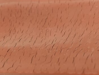 シャルマンブラン(CHARMANTBLANC)/背中のうぶ毛