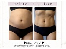 究極のDIET♪一度でも身体の薄みに変化&デトックスでスッキリ