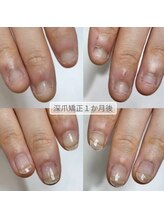 ミンスネイル(Mins Nail)/
