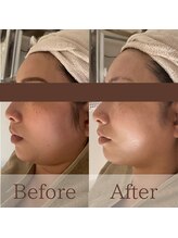 凪眠/小顔リンパフェイシャルの効果25