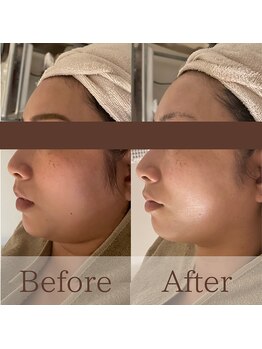 凪眠/小顔リンパフェイシャルの効果25