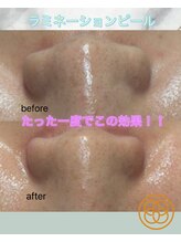 カシェボーテ(CACHE BEAUTE)/