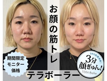 リノ(Lino)/新導入のテラボーラー!