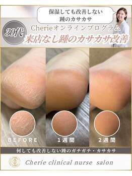 シェリー(Cherie)/長年の踵ガサガサ改善