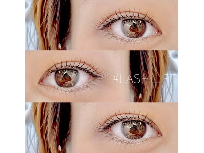 ステラ プラス(stella+)の写真