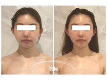 美極 銀座店/銀座/小顔コルギ/小顔矯正