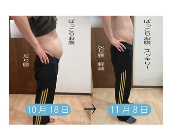 中京こじま整骨院/EMS(JOYトレ)