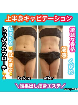 ビューティ ウィッチ(Beauty Witch)/