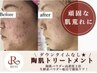 【リピーター様】REVIハーブピーリング+生酵素パウダー1g ¥ 17,400