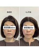 ハリサロンドオフ 堺東店(hari salon de off)/お客様before→after