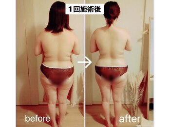 リッカ 中津店(Ricca)/歴11年卓越した根本改善施術