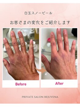 リジュベネ(rejuvena)/首、手のピーリングこみ♪