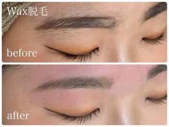 フルミー(fulme.)/WAX脱毛before&after