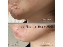 メディカルメイクサロン イマリ(imari)の雰囲気(毛穴/ニキビ/シミシワケア/小顔/痩身/札幌毛穴/札幌ニキビケア)