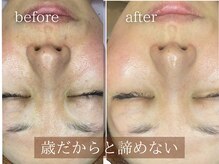 ブラウトクォーツ 渋谷松濤(broutquarts)の雰囲気（通うたび変わる肌、積み重ねで理想の美肌に。年齢を恐れない私へ）
