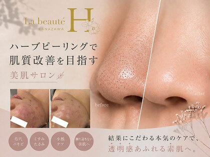 ラボーテアッシュ(La beaute H)の写真