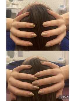 シャルム(CHARME)/頭の浮腫をとって小さく！