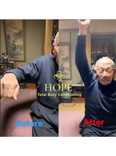 ホープ(HOPE)/◇腱板 損傷/肩が上がらない