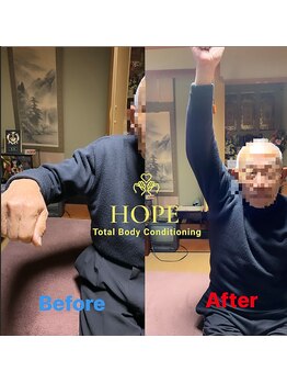 ホープ(HOPE)/◇腱板 損傷/肩が上がらない