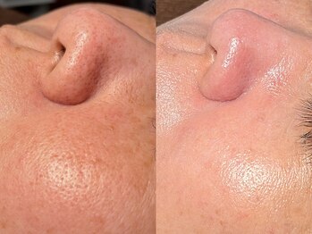 ルーナジェーナ(Luna llena)/池袋　エステ　ルーナジェーナ