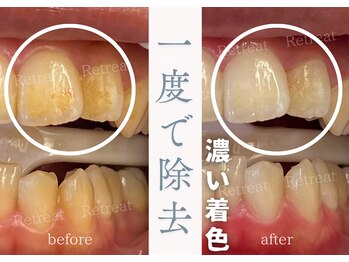 リトリート(Retreat)