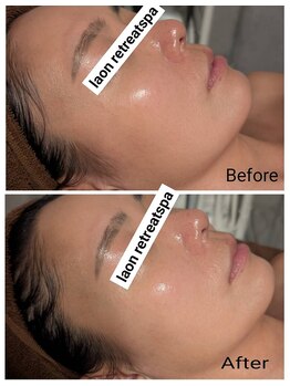 ラオン(laon)/イルミネーティングコース