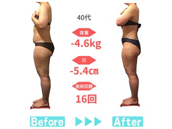 ビースタイル 春日井店(B'style)/40代マイナス4.6キロ