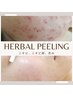 【初回限定】ニキビ・肌荒れケアで肌改善！剥かないハーブピーリング¥11000→