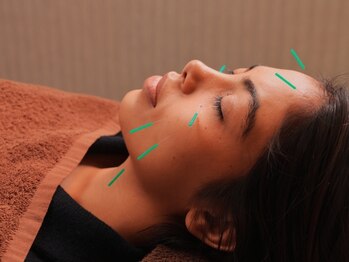 ラビサント 伏見稲荷(Ravissante)の写真/【美容鍼×深層アプローチで驚愕の変化】ベテランの技術で、骨格から整う理想の黄金比小顔へ♪