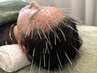 覚醒バリ【深層ルート鍼60分】13000 &nbsp;→ 10000