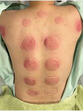 あかし整体院/意外なところにお疲れが