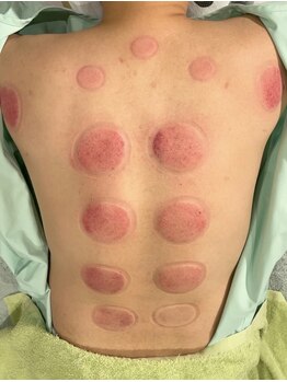 あかし整体院/意外なところにお疲れが