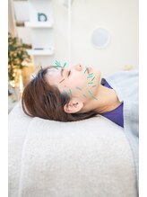 シナジープラス(SYNERGY+)/初めての美容鍼