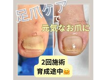 デイジーネイル(Daisy Nail)の雰囲気（爪ケアのプロが足爪ネイルケアで綺麗な足爪へ育てます♪）