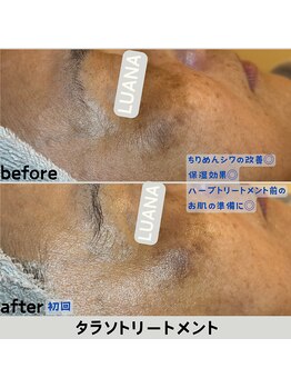 ルアナ 北谷店/タラソケア 《沖縄/北谷》