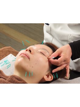 鍼灸施術を受けたい