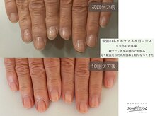 スプレースの雰囲気（お客様ネイル★縦すじにお悩みの方は時間をかけて定期的にケア）