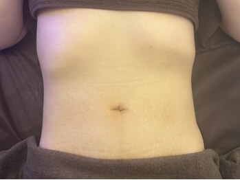 オン(On.)の写真/気になる二の腕・ぽっこりお腹のケアは当店にお任せ◎自信の持てる美ボディで肌魅せの季節も楽しめる♪