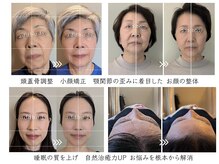 アドボディ(ADD BODY)の雰囲気（お顔の土台から整える整顔施術が人気です。）
