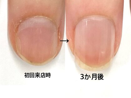 ブリエネイルの写真