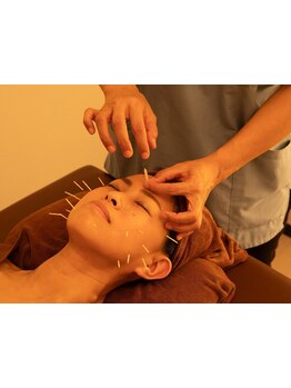 小顔になりたい