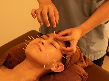 ジネコラボ 町田(Gyneco-labo)の写真/【女性特有のお悩みに!】自律神経を整え、当店1番人気の美顔鍼でうるつや美肌と小顔を手に入れよう★