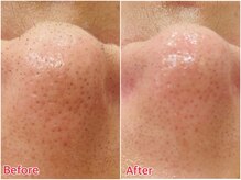 プチ プロムナード(Petit Promenade)/美肌フェイスワックス