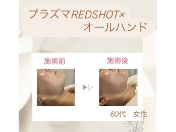 サロン アンド ヨガ マリカ(mallika)